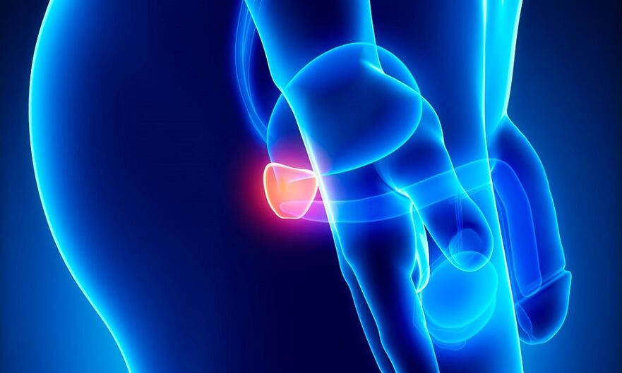 panghubag sa prostate nga adunay prostatitis